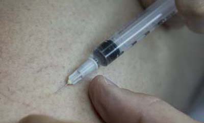 Vaisseau apr&egrave; scl&eacute;rose