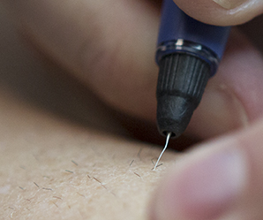 &Eacute;pilation &eacutelectrique &agrave; l'aiguille vue rapproch&eacute;e